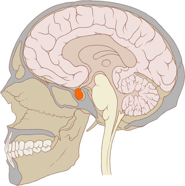 Diabetes insipidus hypofyse